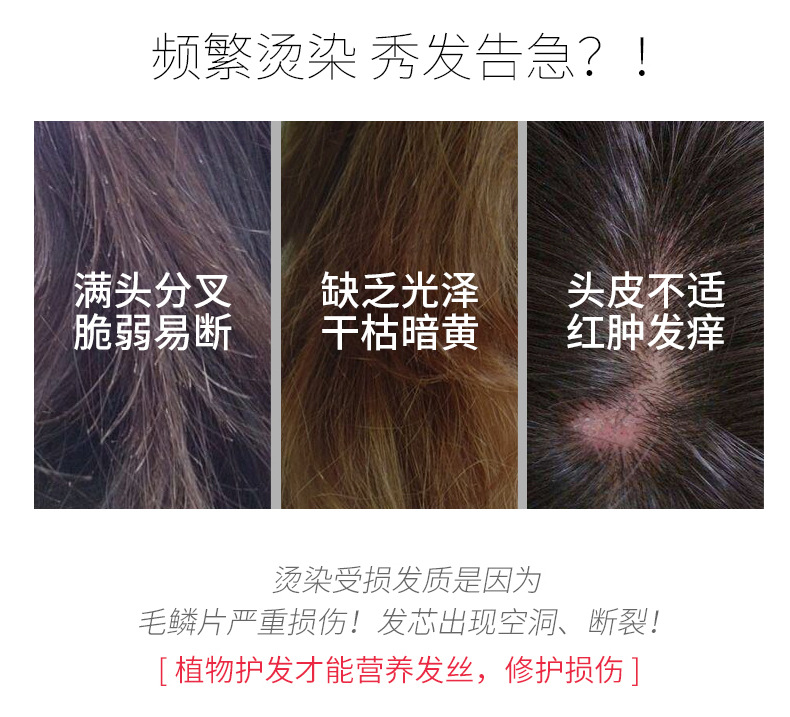 Wholesale Zhenyimei Ginger Anti-Mite Shampoo Set French Fragrance Gold Caviar Shower Gel Wash Nursing Suite Wholesale Zhenyimei Ginger Anti-Mite Shampoo Set French Fragrance Gold Caviar Shower Gel Wash Nursing Suite