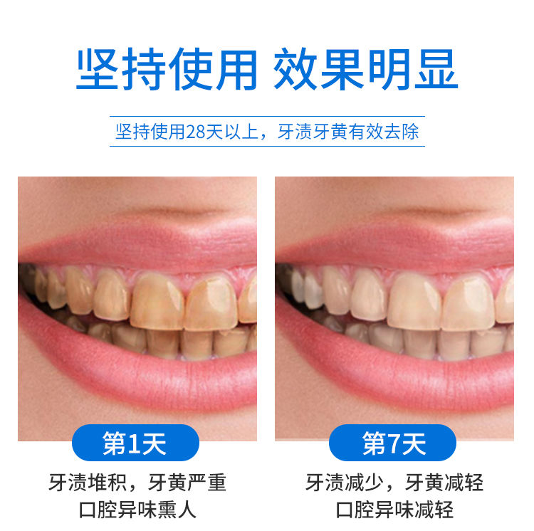 Flavor Toothpaste AntiYellow Tartar Brightening White Removing Smoke Spot Bad Breath Fresh Gum Care Family Affordable