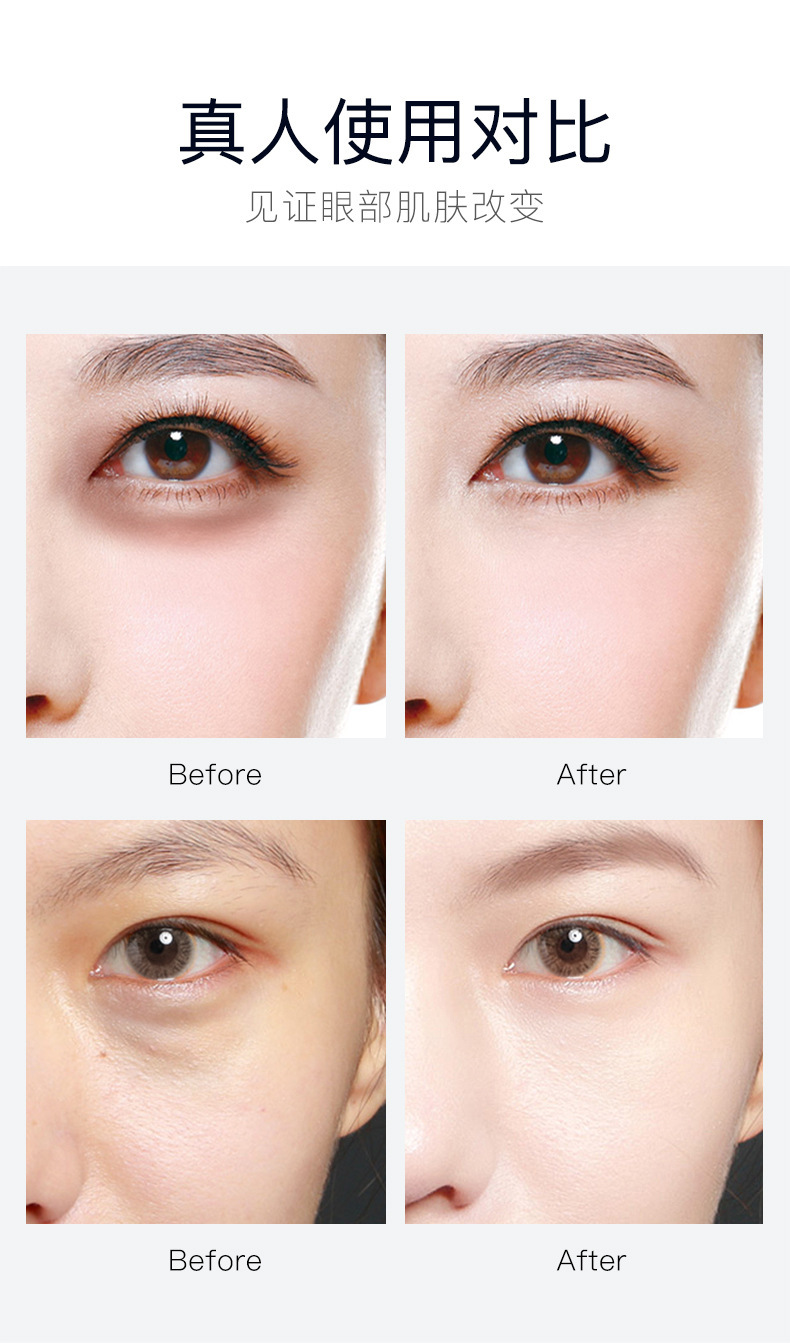 Senana Marina 24K Gold Eye Mask Moisturizing Fade Eye Bags Dark Circles Fine Lines Seaweed Lady Eyes Mask Senana Marina 24K Gold Eye Mask Moisturizing Fade Eye Bags Dark Circles Fine Lines Seaweed Lady Eyes Mask