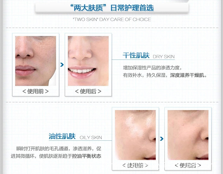 Micro Needle Instrument Pregnant Eyelashes MTS Import Beauty Instrument Wrinkle Removing Acne Essence Import Instrument Micro Needle Instrument Pregnant Eyelashes MTS Import Beauty Instrument Wrinkle Removing Acne Essence Import Instrument