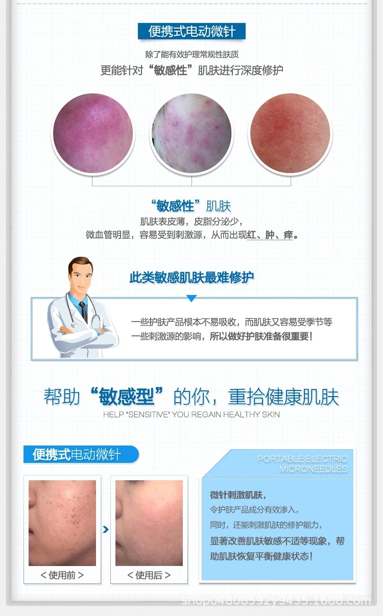 Micro Needle Instrument Pregnant Eyelashes MTS Import Beauty Instrument Wrinkle Removing Acne Essence Import Instrument Micro Needle Instrument Pregnant Eyelashes MTS Import Beauty Instrument Wrinkle Removing Acne Essence Import Instrument