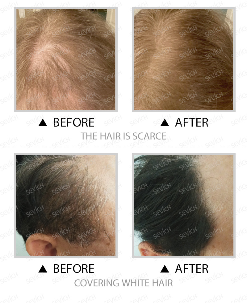 Shadow Rehairing Foundation Natural Repair Filling Modification Hairline Powder Filling Rehairing Highlight Powder Shadow Rehairing Foundation Natural Repair Filling Modification Hairline Powder Filling Rehairing Highlight Powder