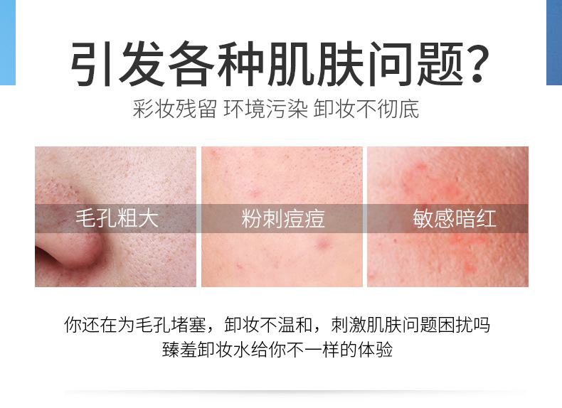 Zhenyan Gentle Cleansing Water Pump Bottle Non-Irritating Facial Cleansing Eyes And Lips Makeup Remover Cleansing Cream Generation Hair 500ml Zhenyan Gentle Cleansing Water Pump Bottle Non-Irritating Facial Cleansing Eyes And Lips Makeup Remover Cleansing Cream Generation Hair 500ml