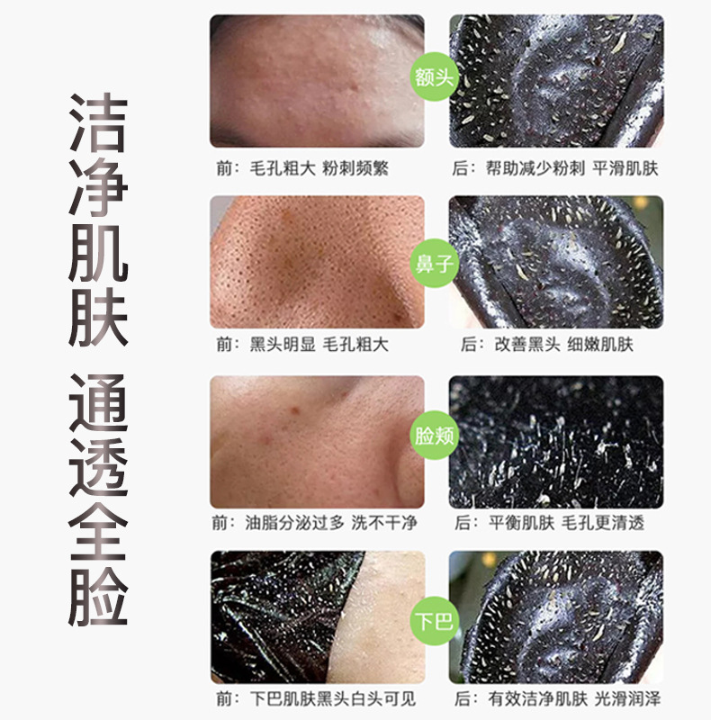 Images Bamboo Charcoal Blackhead Suction Mask Men and Women T District Care Deep Cleansing Oil Control Blackhead Removal Mask