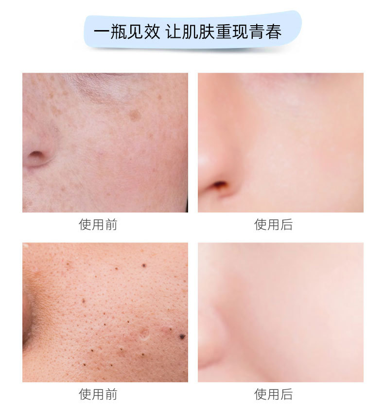Zhi Ran Mei Facial Massage Cream Balance Acid and Alkali Beauty Cleansing Pore Purification Balance Massage Cream Zhi Ran Mei Facial Massage Cream Balance Acid and Alkali Beauty Cleansing Pore Purification Balance Massage Cream